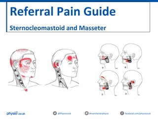 Referral Pain Guide
Sternocleomastoid and Masseter
@Physiocouk #manchesterphysio facebook.com/physiocouk
 