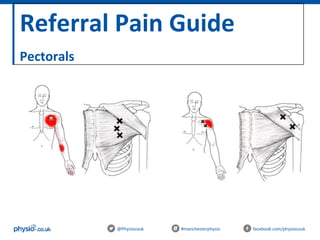 Referral Pain Guide
Pectorals
@Physiocouk #manchesterphysio facebook.com/physiocouk
 