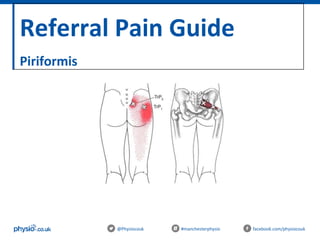 Referral Pain Guide
Piriformis
@Physiocouk #manchesterphysio facebook.com/physiocouk
 