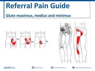 Referral Pain Guide
Glute maximus, medius and minimus
@Physiocouk #manchesterphysio facebook.com/physiocouk
 