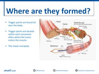 Where are they formed?
@Physiocouk #manchesterphysio facebook.com/physiocouk
• Trigger points are found all
over the body.
.
• Trigger points are located
within each sarcomere
often where the nerve
enters the muscle.
• The motor end plate.
 