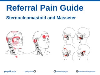 Referral Pain Guide
Sternocleomastoid and Masseter
@Physiocouk #manchesterphysio facebook.com/physiocouk
 