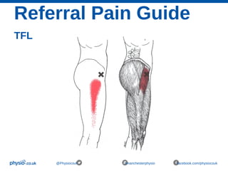 Referral Pain Guide
TFL
@Physiocouk #manchesterphysio facebook.com/physiocouk
 