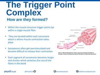 The Trigger Point
Complex
@Physiocouk #manchesterphysio facebook.com/physiocouk
How are they formed?
• Within the muscle structure trigger points lye
within a single muscle fibre
• They are located within each sarcomere
which is where muscle contraction takes
place
• Sarcomeres often get overstimulated and
become difficult to release their contraction
• Each segment of sarcomeres becomes longer
and shorter which stretches the rest of the
fibres in the band
 