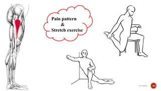 Trigger Points Exercise Trigger point therapy .pptx