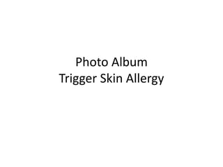 Photo Album
Trigger Skin Allergy
 