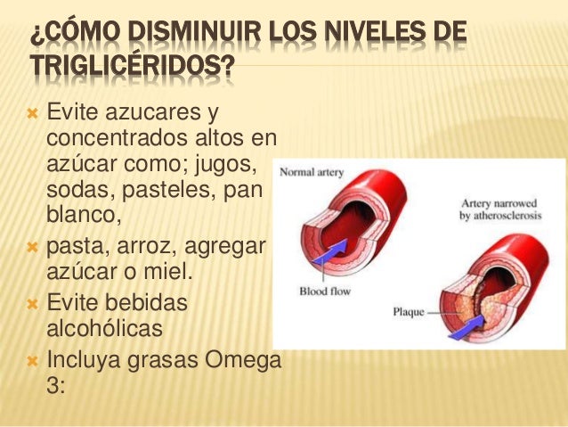 Trigliceridos elevados Trigliceridos elevados