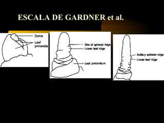 ESCALA DE GARDNER et al.
 