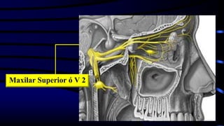 Maxilar Superior ó V 2
 