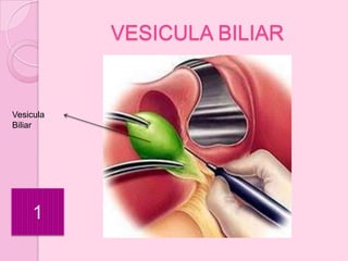 VESICULA BILIAR


Vesicula
Biliar




    1
 