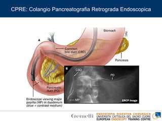 ENDOSCOPIA DIGESTIVA CHIRURGICA
UNIVERSITA’ CATTOLICA DEL SACRO CUORE
EUROPEAN ENDOSCOPY TRAINING CENTRE
CPRE: Colangio Pancreatografia Retrograda Endoscopica
 