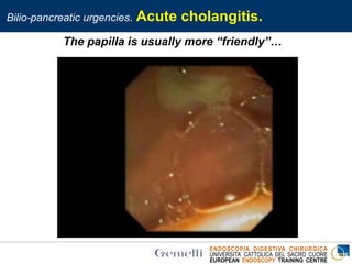 ENDOSCOPIA DIGESTIVA CHIRURGICA
UNIVERSITA’ CATTOLICA DEL SACRO CUORE
EUROPEAN ENDOSCOPY TRAINING CENTRE
Bilio-pancreatic urgencies. Acute cholangitis.
The papilla is usually more “friendly”…
 