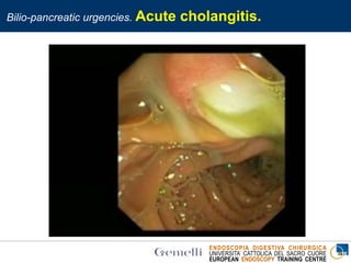 ENDOSCOPIA DIGESTIVA CHIRURGICA
UNIVERSITA’ CATTOLICA DEL SACRO CUORE
EUROPEAN ENDOSCOPY TRAINING CENTRE
Bilio-pancreatic urgencies. Acute cholangitis.
 