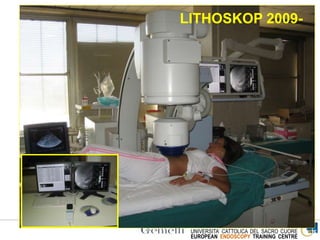 ENDOSCOPIA DIGESTIVA CHIRURGICA
UNIVERSITA’ CATTOLICA DEL SACRO CUORE
EUROPEAN ENDOSCOPY TRAINING CENTRE
Lithostar Plus 1992-2008 LITHOSKOP 2009-
 