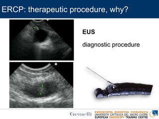 ENDOSCOPIA DIGESTIVA CHIRURGICA
UNIVERSITA’ CATTOLICA DEL SACRO CUORE
EUROPEAN ENDOSCOPY TRAINING CENTRE
ERCP: therapeutic procedure, why?
EUS
diagnostic procedure
 