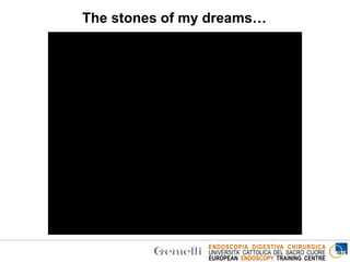 ENDOSCOPIA DIGESTIVA CHIRURGICA
UNIVERSITA’ CATTOLICA DEL SACRO CUORE
EUROPEAN ENDOSCOPY TRAINING CENTRE
The stones of my dreams…
 