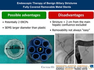 ENDOSCOPIA DIGESTIVA CHIRURGICA
UNIVERSITA’ CATTOLICA DEL SACRO CUORE
EUROPEAN ENDOSCOPY TRAINING CENTRE
Possible advantages
• Potentially 2 ERCPs
• SEMS larger diameter than plastic
Disadvantages
• Stricture < 2 cm from the main
hepatic confluence excluded
• Removability not always “easy”
10 french
10 mm
1 2
76
5 4
3
Endoscopic Therapy of Benign Biliary Strictures
Fully Covered Removable Metal Stents
 