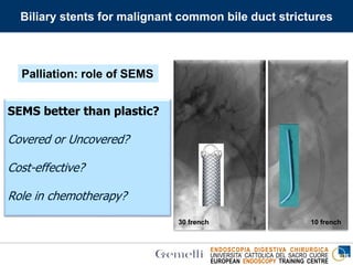 ENDOSCOPIA DIGESTIVA CHIRURGICA
UNIVERSITA’ CATTOLICA DEL SACRO CUORE
EUROPEAN ENDOSCOPY TRAINING CENTRE
SEMS better than plastic?
Covered or Uncovered?
Cost-effective?
Role in chemotherapy?
10 french30 french
Biliary stents for malignant common bile duct strictures
Palliation: role of SEMS
 
