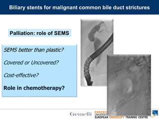 ENDOSCOPIA DIGESTIVA CHIRURGICA
UNIVERSITA’ CATTOLICA DEL SACRO CUORE
EUROPEAN ENDOSCOPY TRAINING CENTRE
Palliation: role of SEMS
SEMS better than plastic?
Covered or Uncovered?
Cost-effective?
Role in chemotherapy?
Biliary stents for malignant common bile duct strictures
 