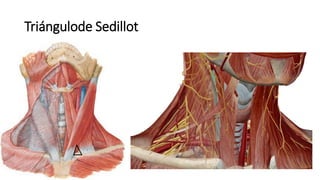 Triángulode Sedillot
 