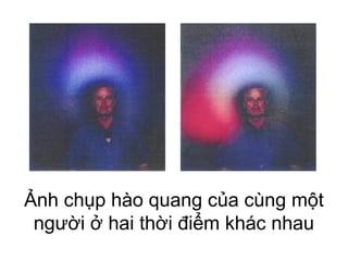 Ảnh chụp hào quang của cùng một
người ở hai thời điểm khác nhau
 