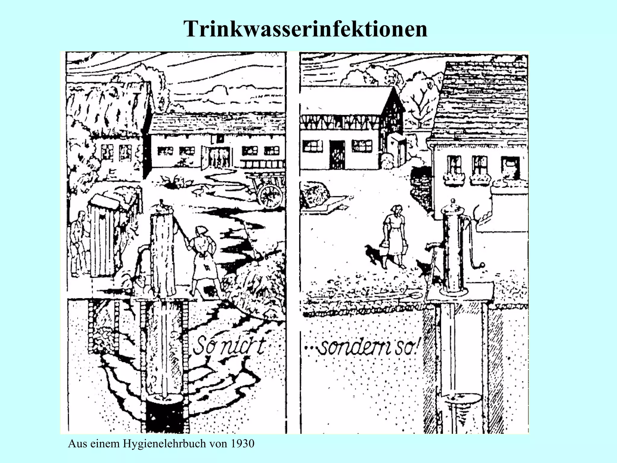 Trinkwasserinfektionen  Aus einem Hygienelehrbuch von 1930 