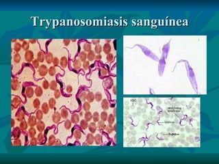 Trypanosomiasis sanguínea 