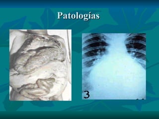 Patologías  