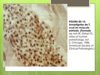 FIGURA 83-15.
Amastigotes de T.
cruzi en músculo
estriado. (Tomado
de Ash tR, Orihel TC:
Atlas of human
parasitology, ed
2, Chicago, 1984,
American Society of
Clinical Pathologists.)
 