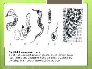 Fig. 81.4. Trypanosoma cruzi.
a), b) y c) Tripomastigotes en sangre. d), e) Epimastigotes
(con membrana ondulante corta anterior). f) Colonia de
amastigotes en células del músculo cardíaco.
 