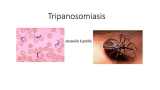 Tripanosomiasis
Janseilin Castillo
 