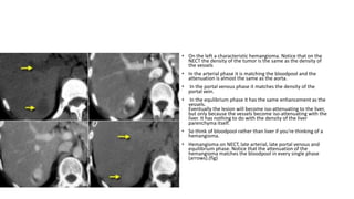 Absccess Triphasic Ct Scan Triphasic CT scan | PPTX