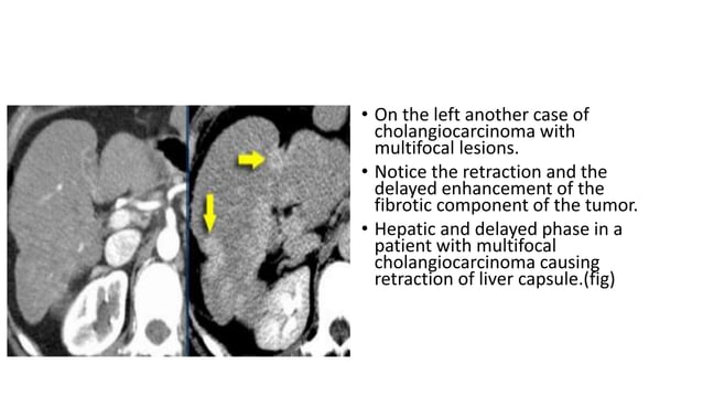 Triphasic CT scan | PPTX