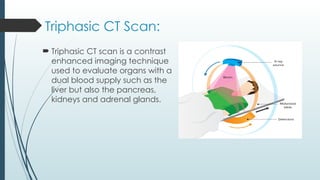 Triphasic CT Scan of Liver radiology.pptx