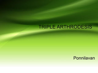 TRIPLE ARTHRODESIS
Ponnilavan
 