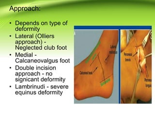 Approach:
• Depends on type of
deformity
• Lateral (Olliers
approach) -
Neglected club foot
• Medial -
Calcaneovalgus foot
• Double incision
approach - no
signicant deformity
• Lambrinudi - severe
equinus deformity
 