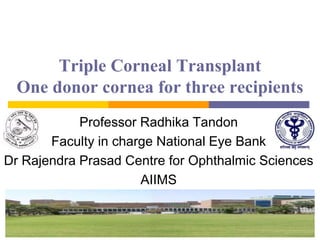 Triple Corneal Transplant
One donor cornea for three recipients
Professor Radhika Tandon
Faculty in charge National Eye Bank
Dr Rajendra Prasad Centre for Ophthalmic Sciences
AIIMS
 