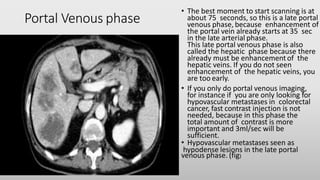 Portal Venous phase
• The best moment to start scanning is at
about 75 seconds, so this is a late portal
venous phase, because enhancement of
the portal vein already starts at 35 sec
in the late arterial phase.
This late portal venous phase is also
called the hepatic phase because there
already must be enhancementof the
hepatic veins. If you do not seen
enhancement of the hepatic veins, you
are too early.
• If you only do portal venous imaging,
for instance if you are only looking for
hypovascular metastases in colorectal
cancer, fast contrast injection is not
needed, because in this phase the
total amount of contrast is more
important and 3ml/sec will be
sufficient.
• Hypovascular metastases seen as
hypodense lesions in the late portal
venous phase. (fig)
 