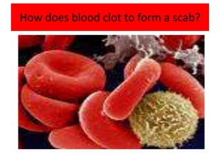 How does blood clot to form a scab?

 