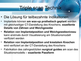 Triple scan Technik
• Die Lösung für teilbezahnte Indikationen:
• Implantate können am wax-up prothetisch geplant werden
mit gleichzeitiger CT-Darstellung des Knochens, exzellente
Details von Zähnen und Weichgewebe
• Relation von Implantatposition und Weichgewebsniveau
kann erstmals durch Visualisierung am Situationsmodell
verifiziert werden
• Relation von Implantatposition und krestalem Knochen
wird verifiziert an der CT-Darstellung des Knochens
• Fabrikation des zahngestützten surgical guides am scan des
Situationsmodells – exzellente Passform
 