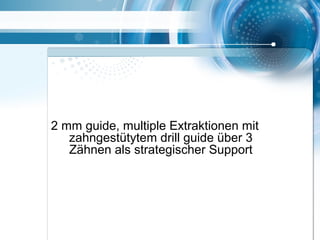 2 mm guide, multiple Extraktionen mit
zahngestütytem drill guide über 3
Zähnen als strategischer Support
 