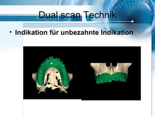 Dual scan Technik
• Indikation für unbezahnte Indikation
 