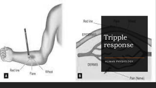 Triangular Response triple response on skin based on physiology | PPTX