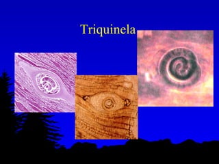 Triquinela  