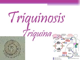 Triquinosis 
Triquina 
 