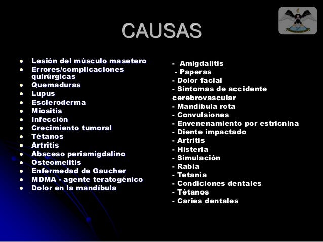 Trismus Trismus