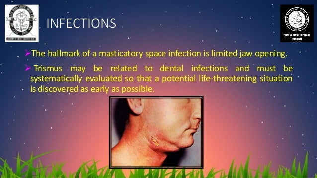 differential diagnosis of trismus trismus