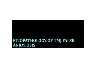 ETIOPATHOLOGY OF TMJ FALSE
ANKYLOSIS
 