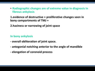 ▪ Radiographic changes are of extreme value in diagnosis In
fibrous ankylosis
1.evidence of destructive + proliferative changes seen in
bony compartments of TMJ +
2.haziness or narrowing of joint space
In bony ankylosis
- overall obliteration of joint space.
- antegonial notching anterior to the angle of mandible
- elongation of coronoid process
 