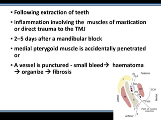 ▪ Following extraction of teeth
▪ inflammation involving the muscles of mastication
or direct trauma to the TMJ
▪ 2–5 days after a mandibular block
▪ medial pterygoid muscle is accidentally penetrated
or
▪ A vessel is punctured - small bleed haematoma
 organize  fibrosis
 